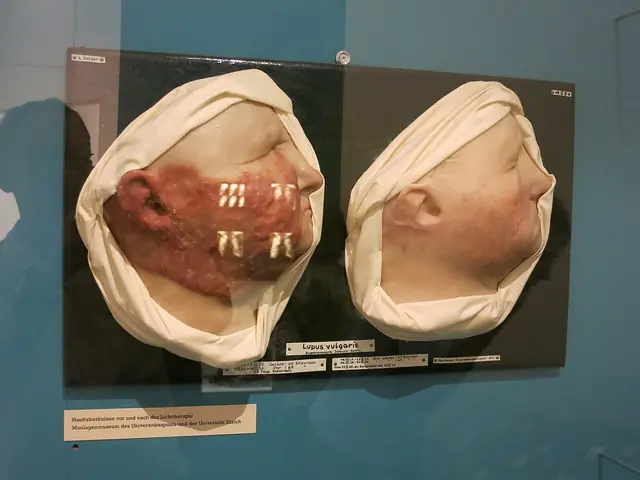 Moulagenmuseum in Zürich